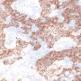 Cytokeratin
