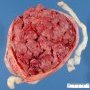 Normal placenta