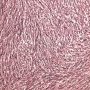 Monophasic synovial sarcoma