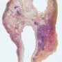 Menopausal ovary