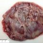 Ovarian mucinous cystadenoma