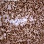 Desmin immunostaining