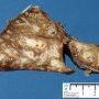 Bronchiectasis and BALT hyperplasia (Case 11750)