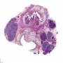 Fetal esophagus (20 weeks)