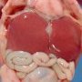 Megacystis with intravesical meconium