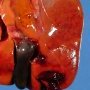 Hepatic ischemia in a systemic sepsis