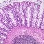 Colonic mucosa