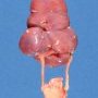 Renal fusion