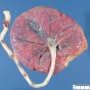 Normal placenta (28 weeks)