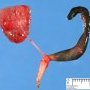 Unilateral renal agenesis with cystic renal dysaplasia. Anorectal agenesis (...)