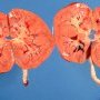 Kidneys