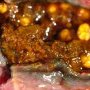 Cholelithiasis and biliary sludge