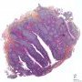 Lymphoid follicles in normal tonsil (H&E)
