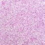 Dermatofibrosarcoma protuberans