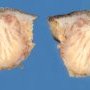 Necrotizing granulomatous dermatitis in cutaneous mycobacteriosis