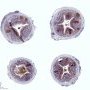 CD20 in normal appendix