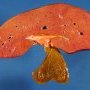 Liver and gallbladder
