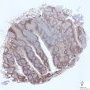 Lymphoid follicles in normal tonsil (Bcl-2)