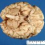 Brain (6 months)