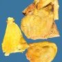 Slight fibrinous pericarditis and cholestatic jaundice