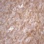 EMA (Epithelial Membrane Antigen)
