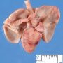 Dextrocardia in situs inversus (24 weeks)
