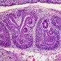 EMbryonic kidney