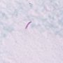 Ziehl–Neelsen stain (Courtesy of Dr Yale Rosen)