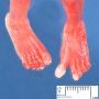 Toe spacing