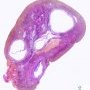 Normal ovary (21 years)