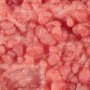 Familial adenomatous polyposis (FAP)