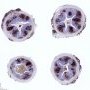 CD20 in normal appendix
