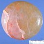 Ovarian serous cystadenoma