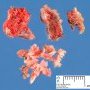 Normal bone fragment