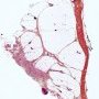 Hypodermis and fascia