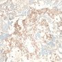alpha-fetoprotein