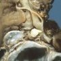 Cystic nephroma