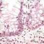 Inflammatory apoptotic cells in chronic colitis (Legends)