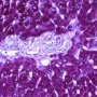 Normal portal space and interlobular biliary ducts in juvenile (...)