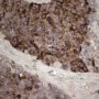 EMA immunostaining