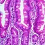 Intestinal villi