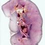 Fetal kidney 27 weeks