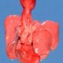 fetal mediastinum (20 weeks)