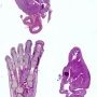 Fetal foot 13 weeks