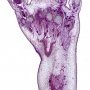 Fetal foot 15 weeks