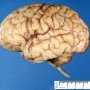 Brain (6 months)