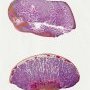 Fetal testis 39 weeks