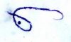 Microfilaria of Mansonella ozzardi.