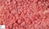 Colonic adenomatous polyposis. 3