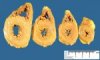 Myocardium in cholestatic jaundice